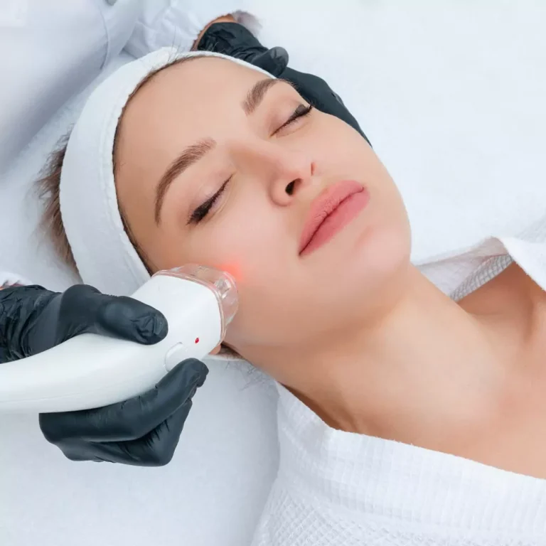 trattamento-laser-macchie-viso